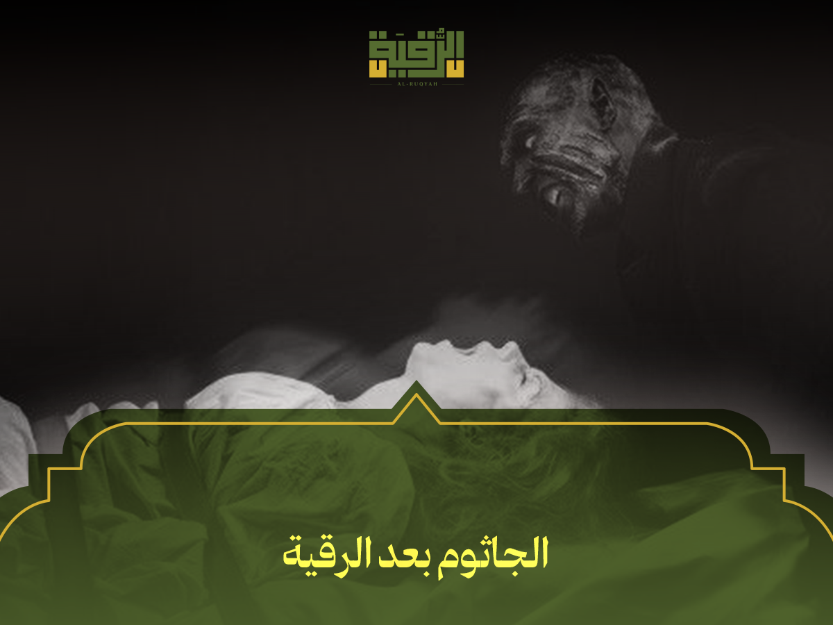 الجاثوم بعد الرقية